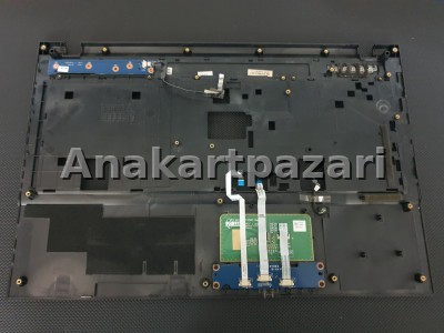 Exper Karizma A5V A5B Üst Kasa + Touchpad