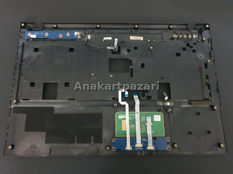 Exper Karizma A5V A5B Üst Kasa + Touchpad