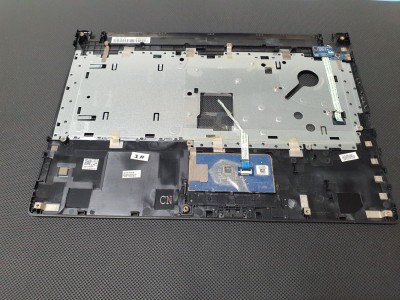 Lenovo Z40-70 Z40-75 Z40-80 Üst Kasa